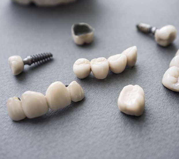 Vienna The Difference Between Dental Implants and Mini Dental Implants