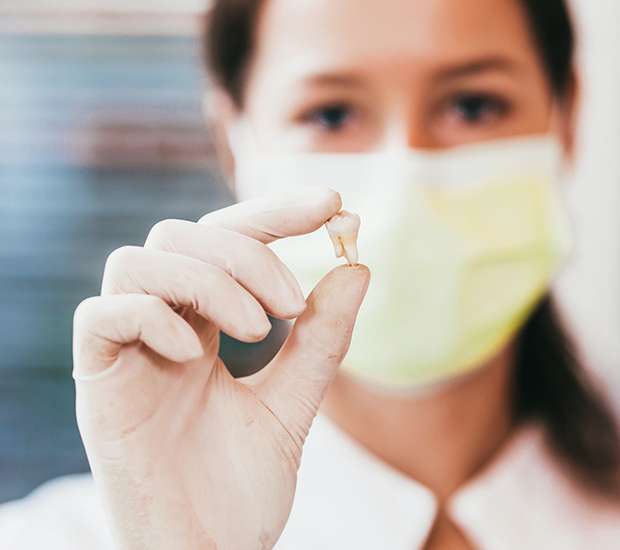 Vienna Tooth Extraction